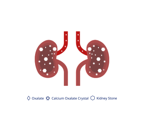 Chronic kidney disease